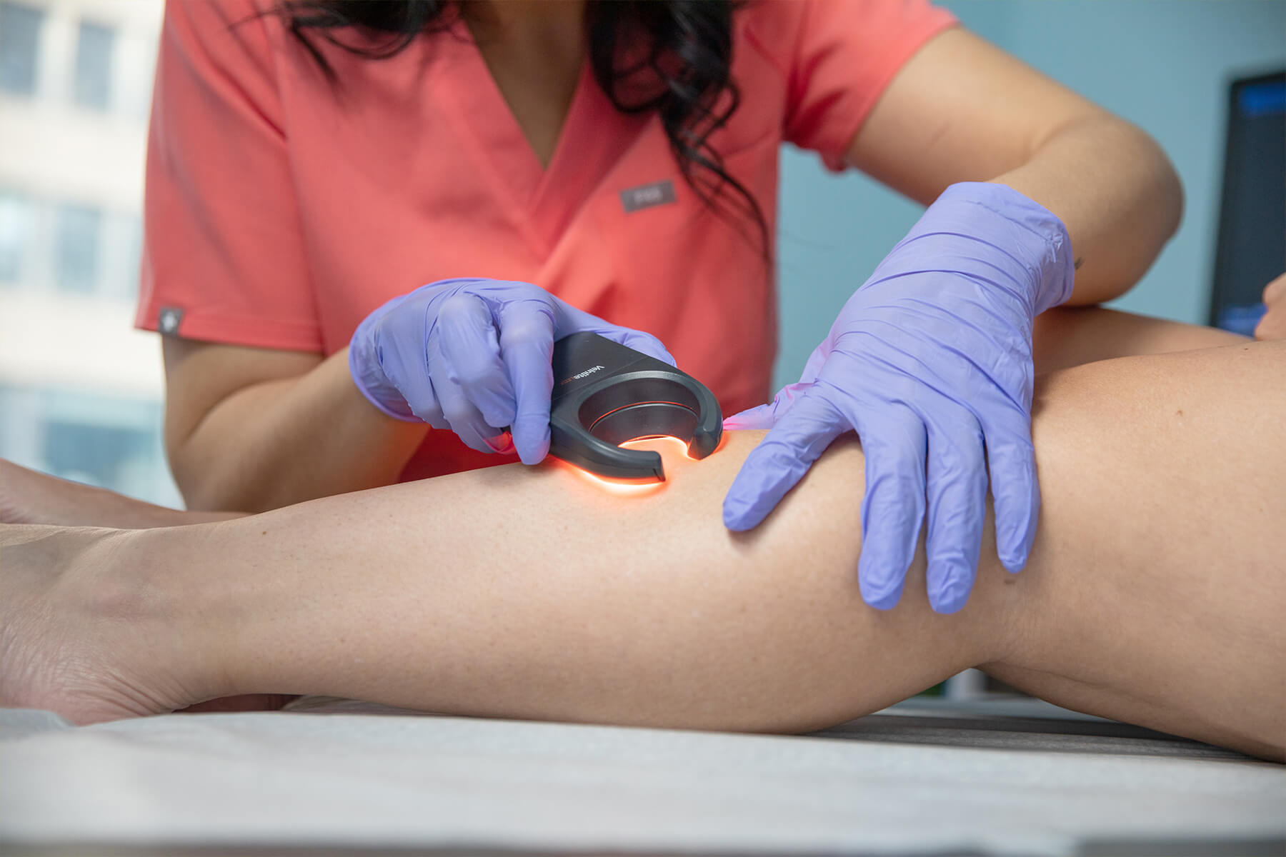 treating vein conditions