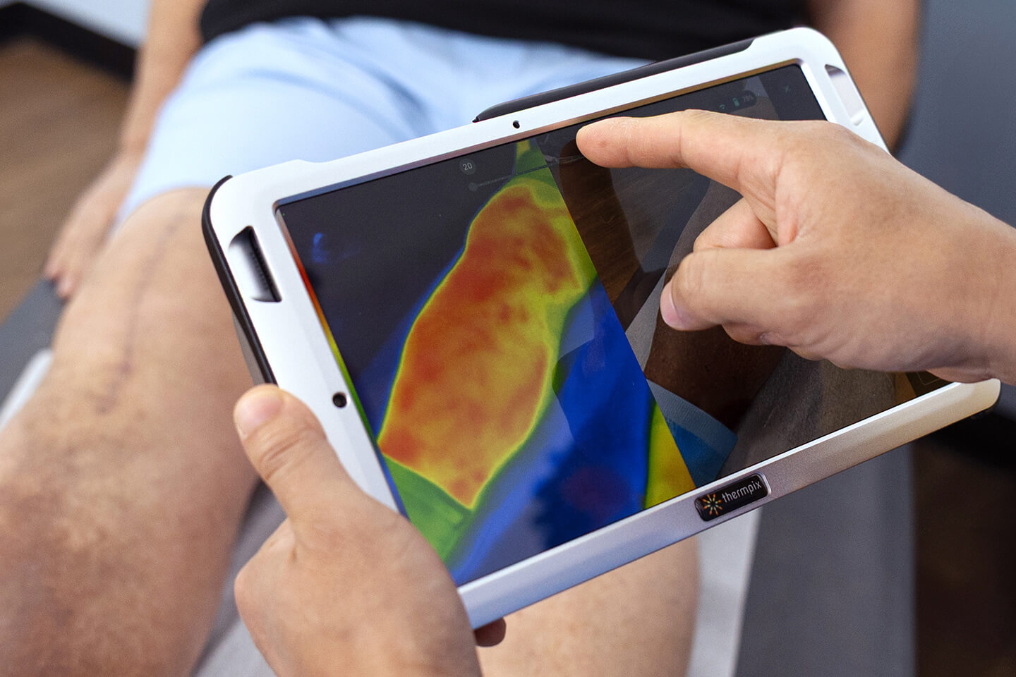 vein mapping