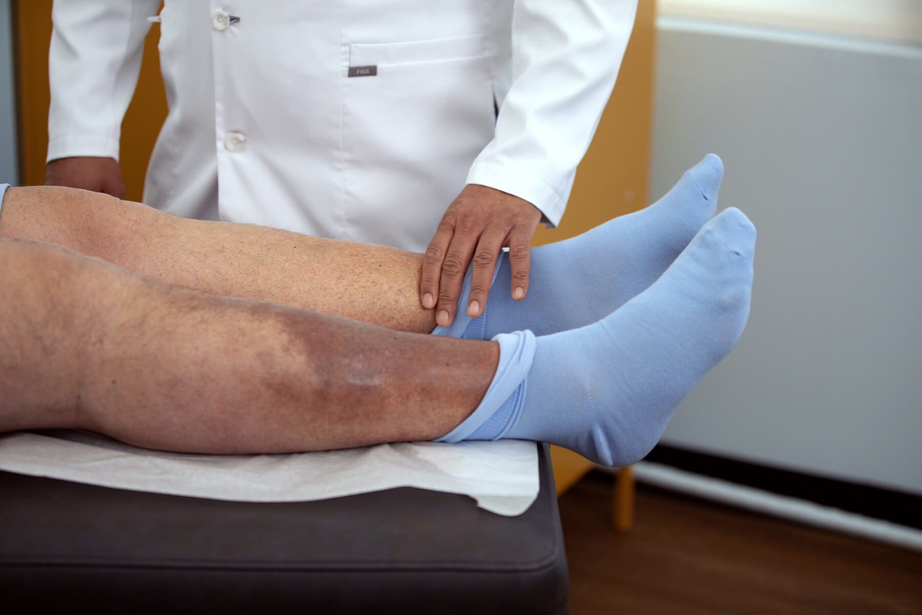 hyperpigmentation in legs