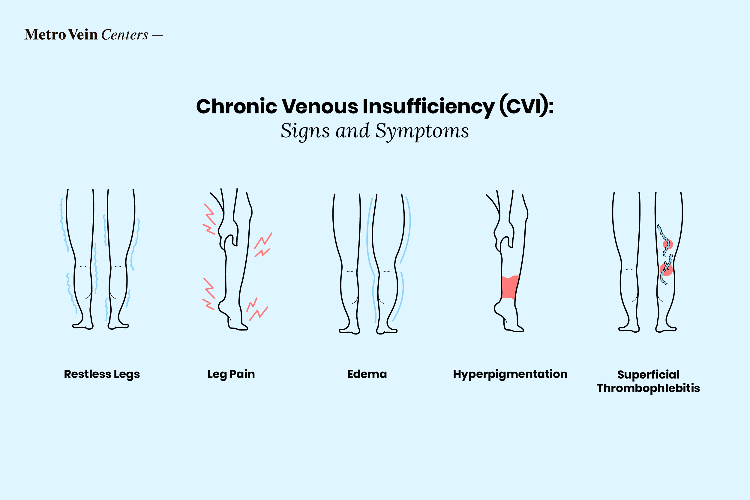 CVI signs and symptoms