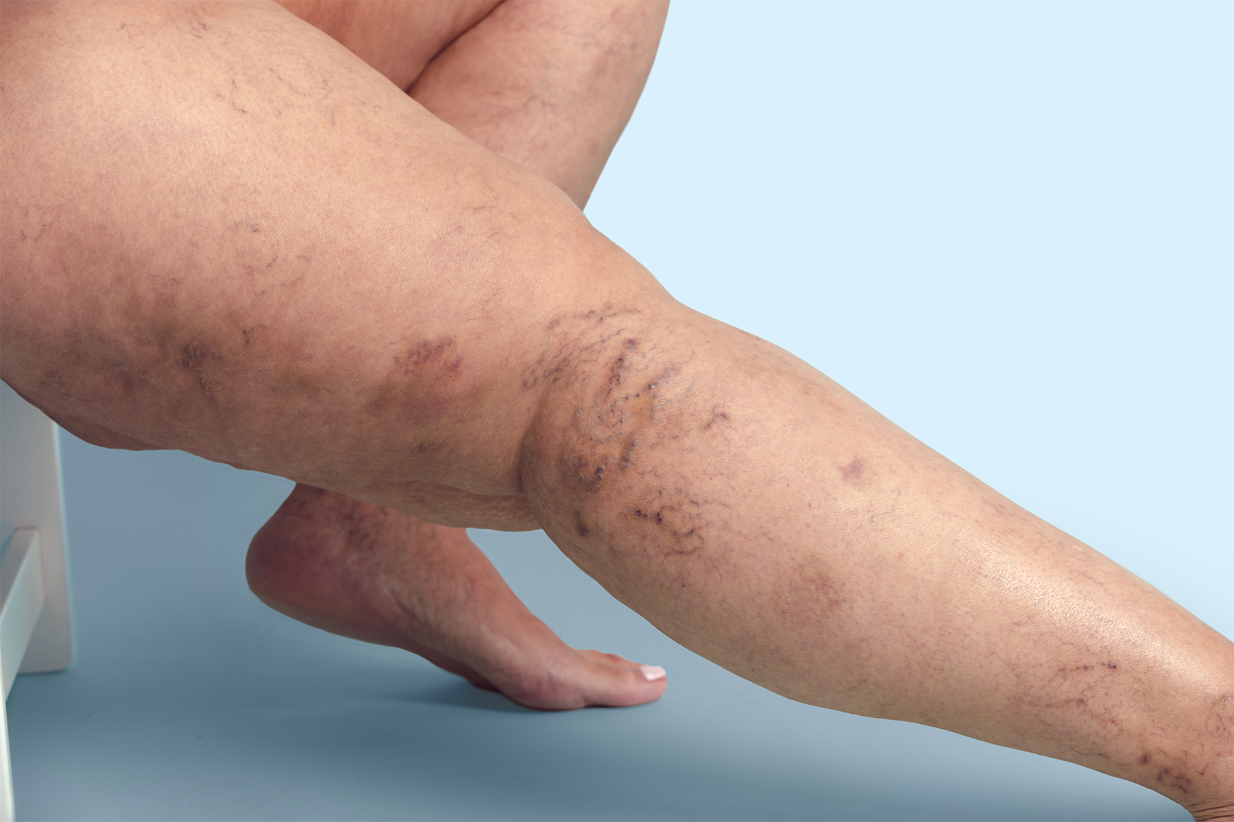 Explore las diferencias anat&oacute;micas y funcionales entre las venas del tobillo, el pie y la pierna, y aprenda c&oacute;mo estas variaciones afectan la salud vascular.