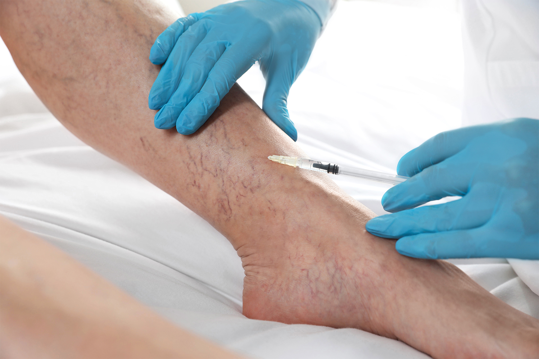 Explore las diferencias anat&oacute;micas y funcionales entre las venas del tobillo, el pie y la pierna, y aprenda c&oacute;mo estas variaciones afectan la salud vascular.