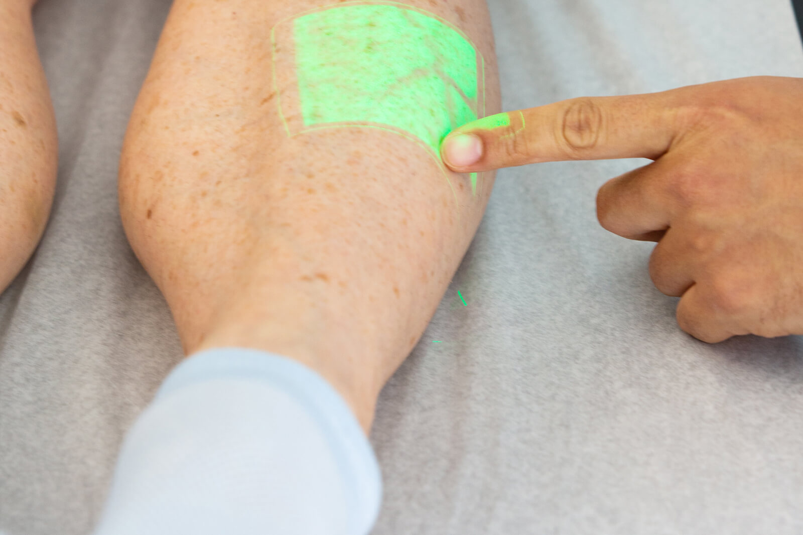 Aprende a identificar las complicaciones post-tratamiento despu&eacute;s de procedimientos en las venas. Comprende los s&iacute;ntomas, recibe consejos para la recuperaci&oacute;n y sabe cu&aacute;ndo buscar ayuda m&eacute;dica.