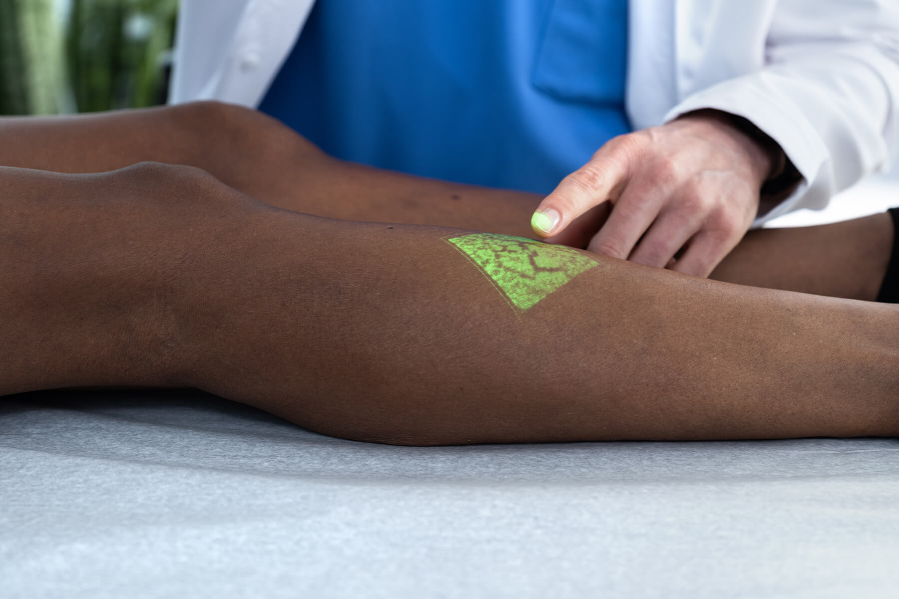 vein evaluation