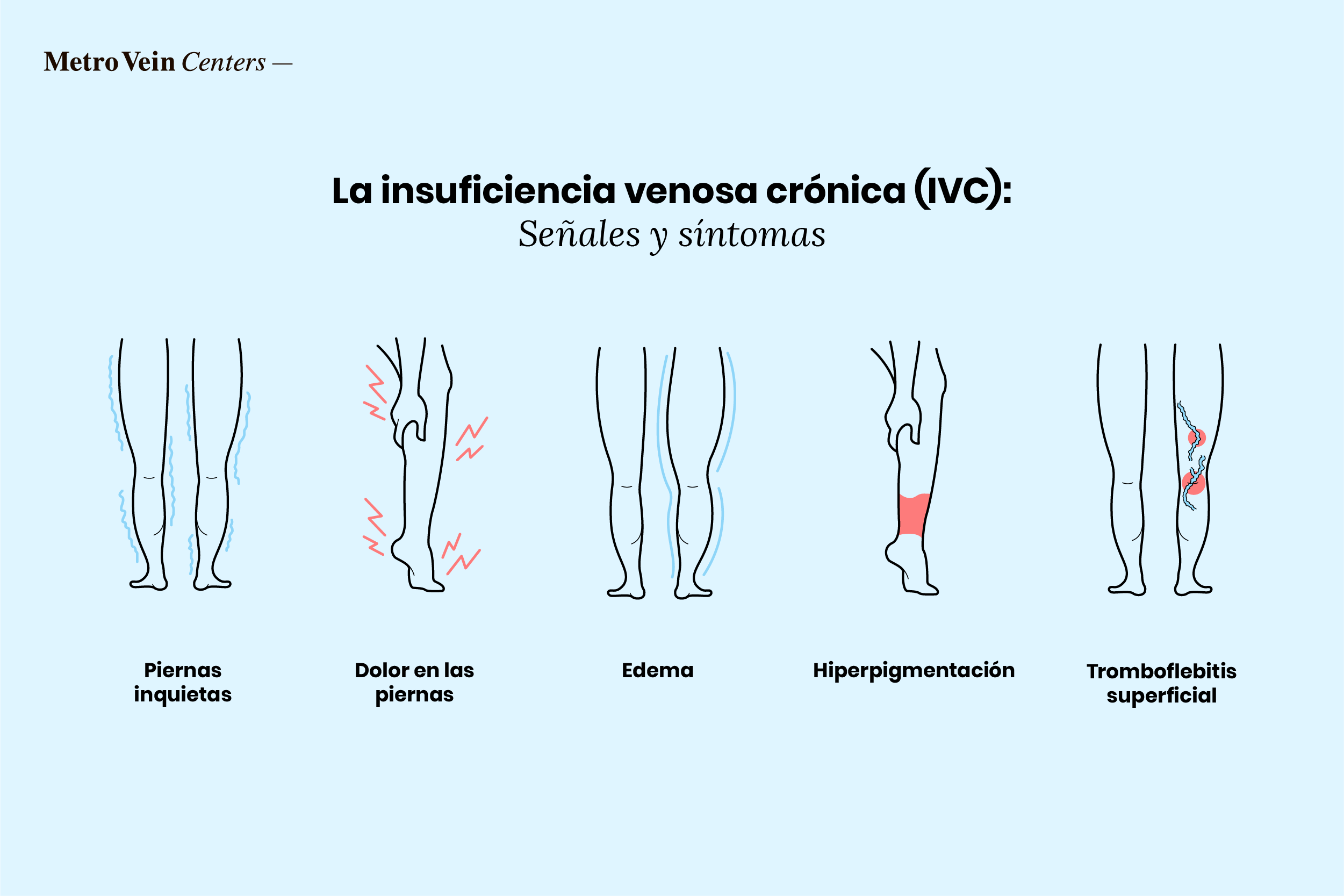 IVC